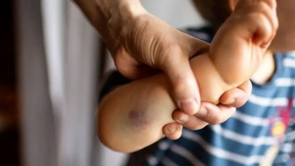 Denuncian maltrato a bebé de cinco meses a manos de su madre